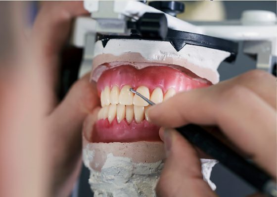 Consórcio prevê até R$ 3,6 milhões em próteses dentárias